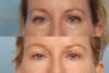 http://skincaresfreetrial.com/hydrayouth/