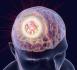 brain health & memory Explained