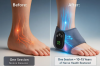 Foot Renew Review 2026[Does Foot Renew Really Work]